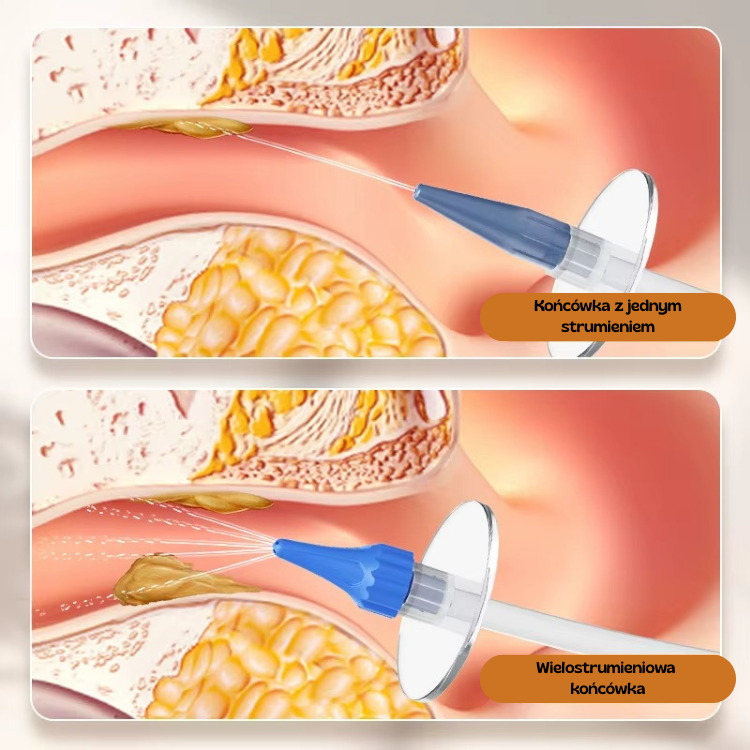 AuriPure™ – Ręczny System Płukania Uszu