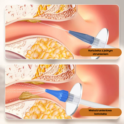 AuriPure™ – Ręczny System Płukania Uszu